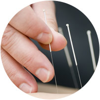 Try acupuncture for fertility